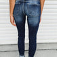 Vintage Washed Two-button High Waist Skinny Jeans